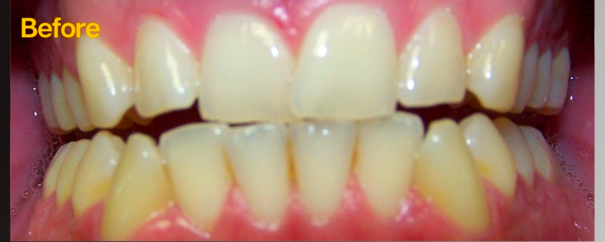 Before image